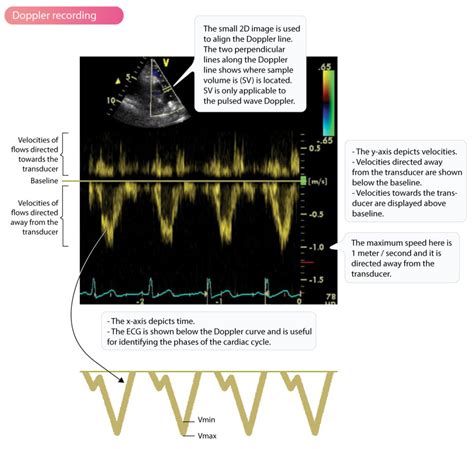 what is 2d echocardiogram with doppler|Doppler effect and Doppler echocardiography – .